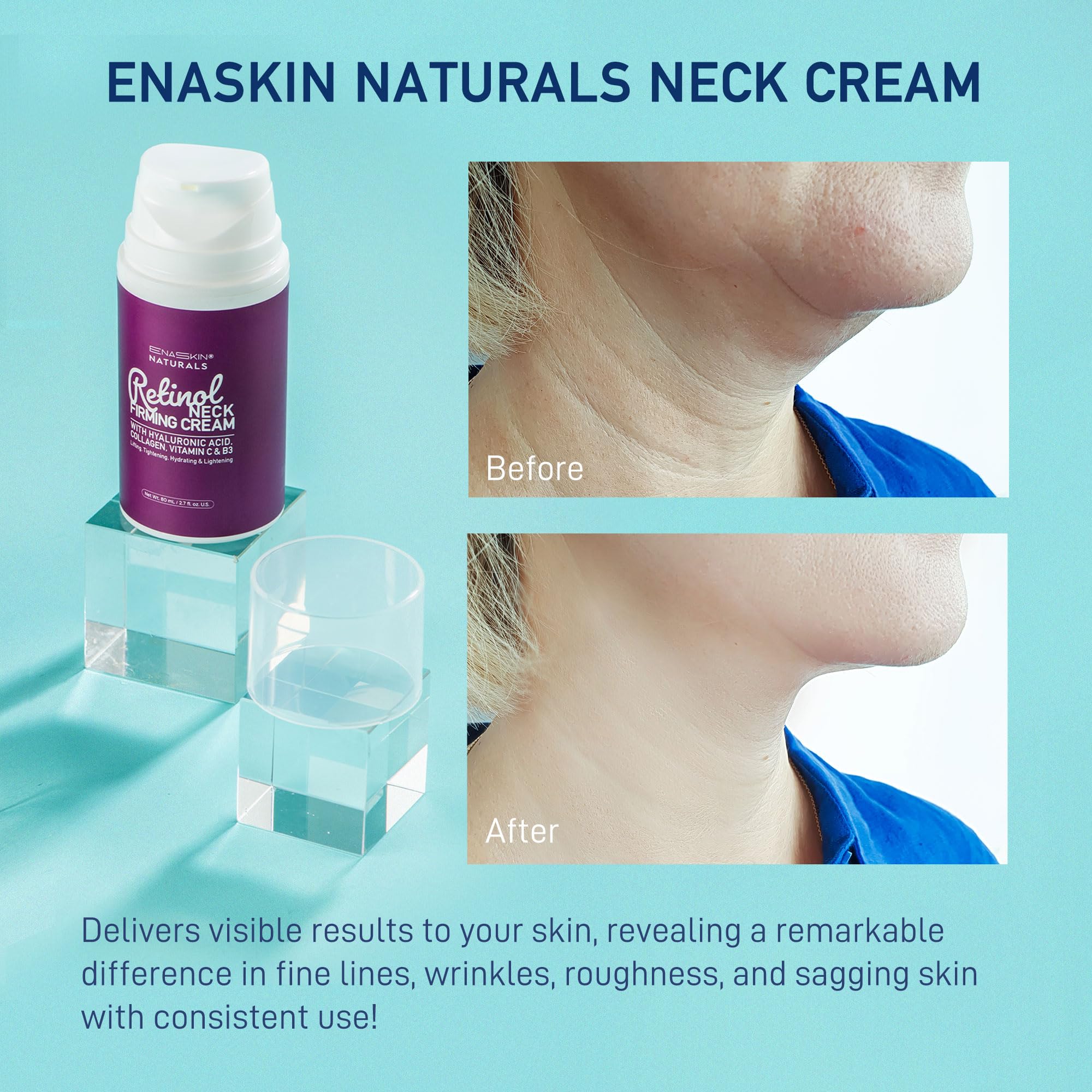 Retinol Neck Firming Cream: Advanced Face Tightening and Lifting Cream with Hyaluronic Acid, Collagen and Vitamin - Tightening Wrinkles, Firming Sagging Skin on Face, Neck, Décolleté - 2.7 Oz - Image 8