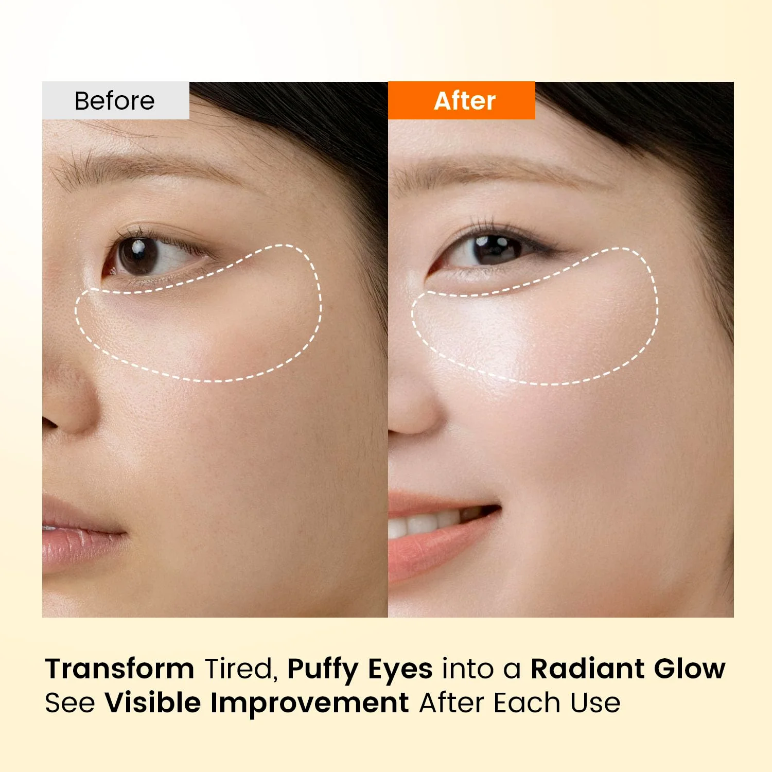 SEONGLOW Caffeine Under Eye Patches: 30 Pairs Korean Hydrogel Eye Masks for Dark Circles Puffiness Relief with Niacinamide Hyaluronic Acid - Undereye Brightening Hydrating Anti-Wrinkle Treatment - Image 6