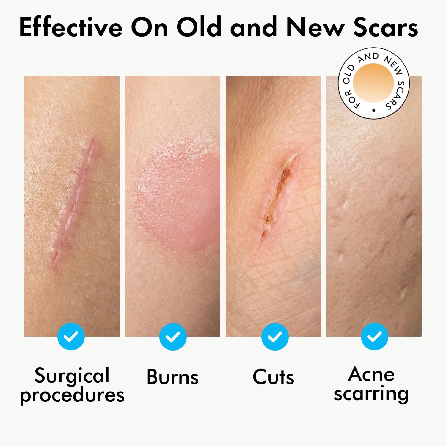 Serica Scar Gel (1oz), Advanced Silicone Formula, Supports Visibly Smoother-Looking Skin After Surgery, Cuts, Burns or Acne, Non-Comedogenic Face-Safe Gel, Helps Reduce Dryness, Quick-Dry - Image 7