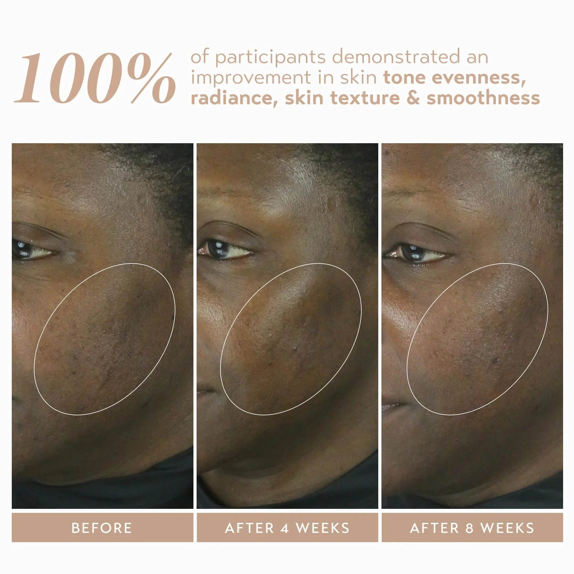 SHANI DARDEN SKIN CARE Retinol Reform with 1% Encapsulated Retinol Serum for Face & Neck, Gentle Slow-Release Face Serum with Tripeptide for Wrinkles, Fine Lines & Uneven Tone, 1 fl oz - Image 5
