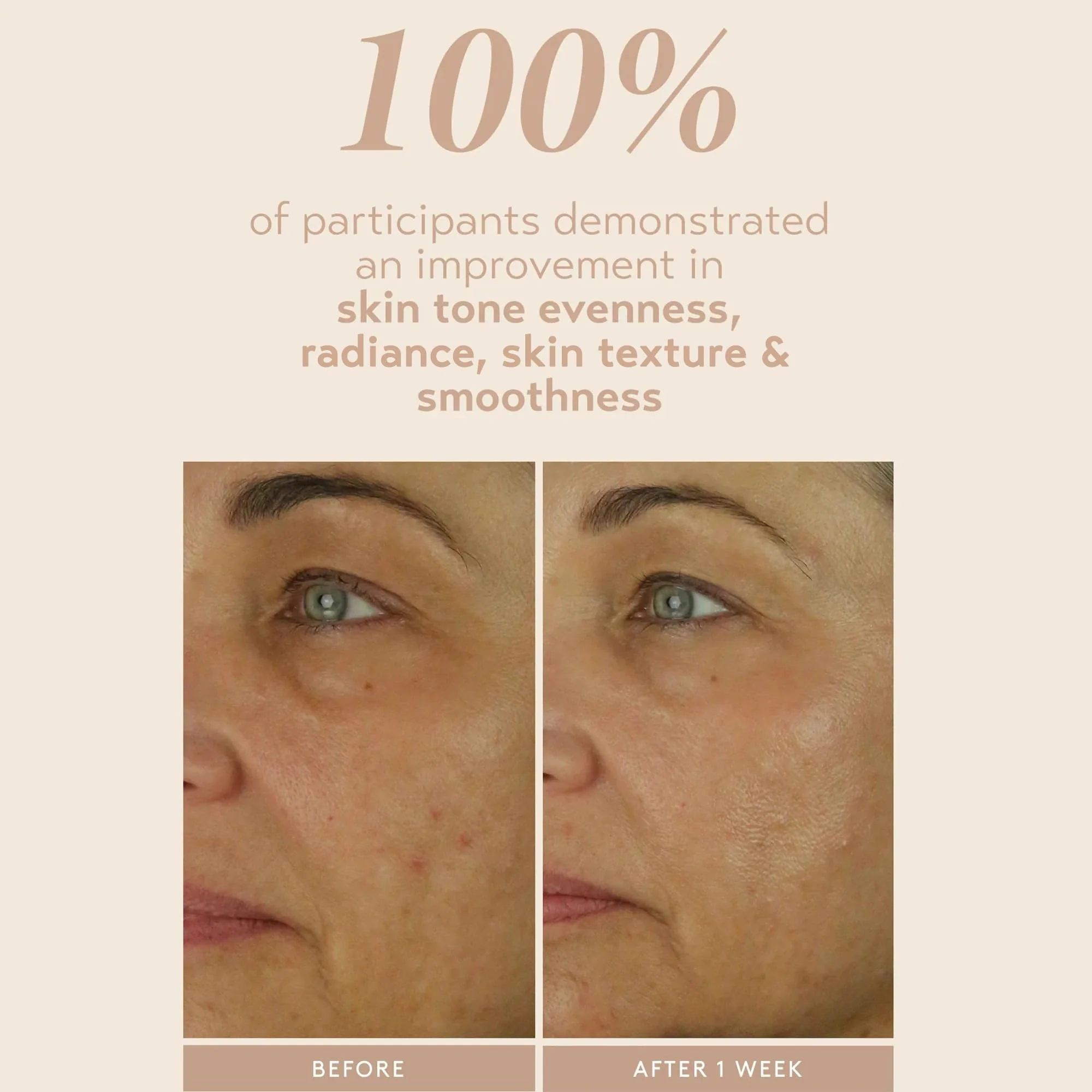 SHANI DARDEN SKIN CARE Retinol Reform with 1% Encapsulated Retinol Serum for Face & Neck, Gentle Slow-Release Face Serum with Tripeptide for Wrinkles, Fine Lines & Uneven Tone, 1 fl oz - Image 6