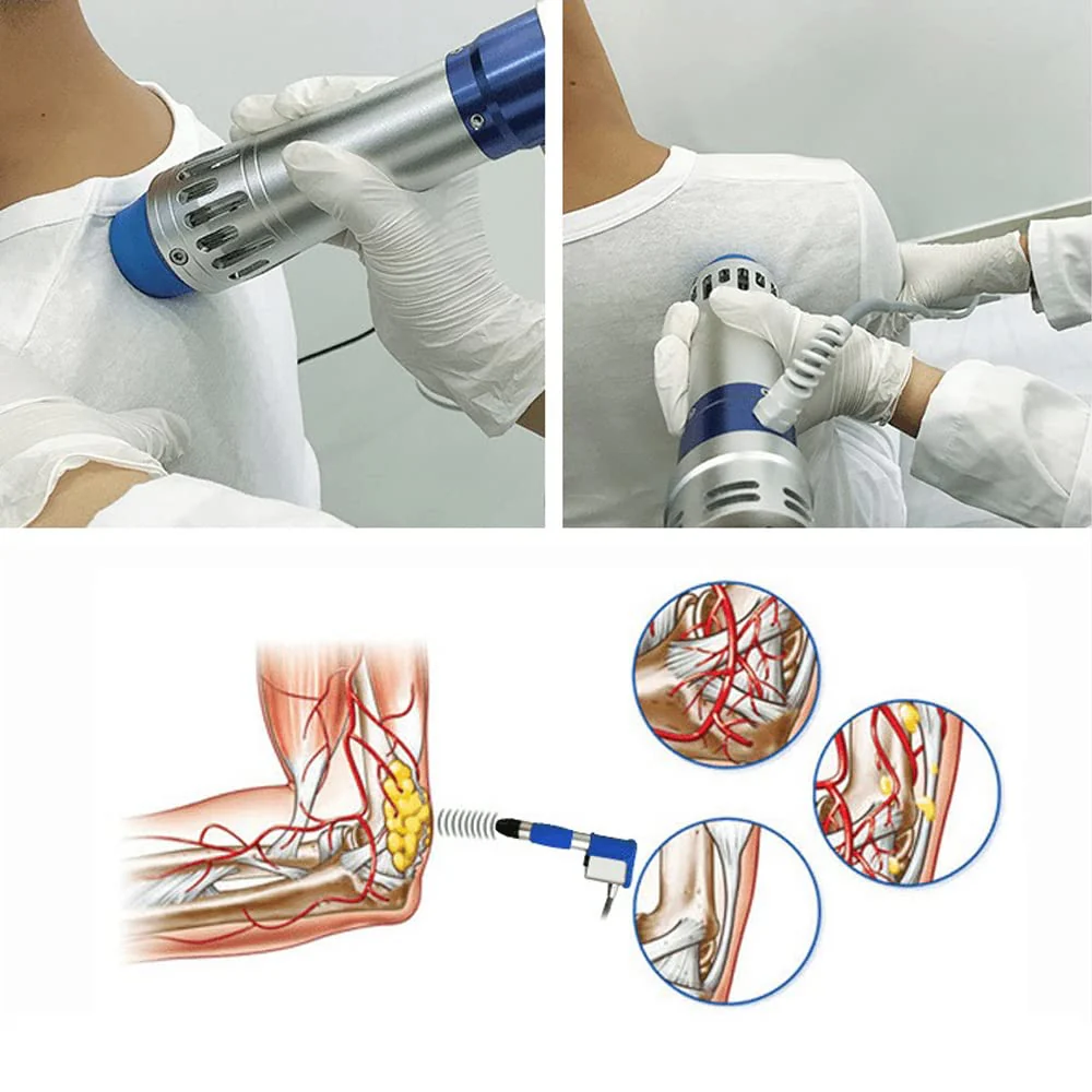 Shockwave Therapy Machine, Effective Electromagnetic Extracorporeal Shock Wave Therapy Machine Pain Relief Body Massager Muscle Relax Massage Gun with 7 Massage Heads - Image 4