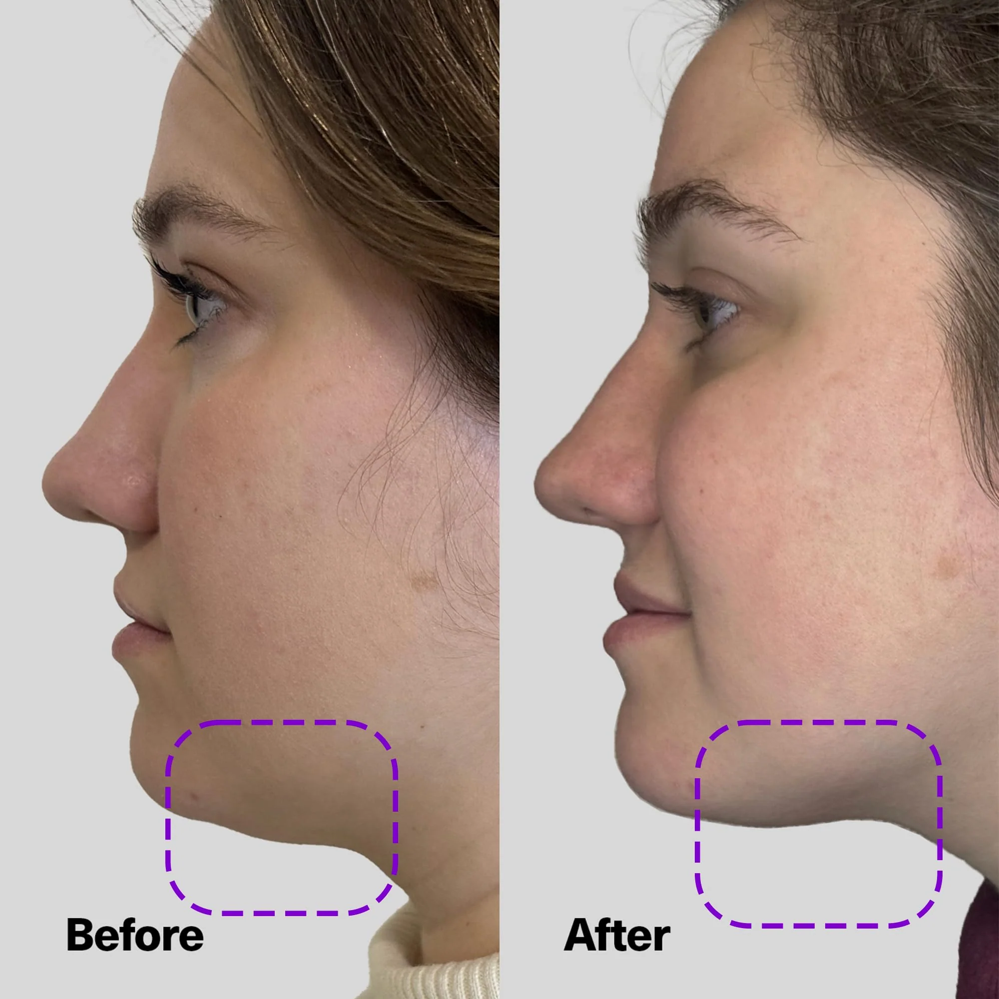 SickScience ShapeShift Advanced Jaw & Neck Firming Serum - Double Chin Reducer, Face Tightening Treatment with Exosome Technology to Lift Sagging Skin & Wrinkles in both Women & Men, 1.7oz - Image 7