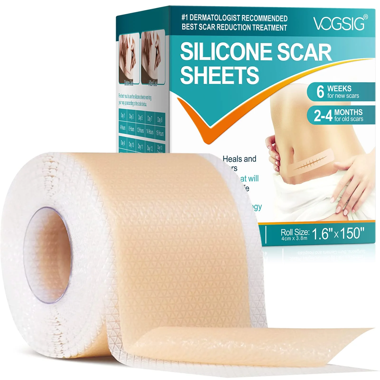Silicone Scar Sheets,Silicone Scar Tape Roll,Medical Grade Silicone Tape for Scar Removal,Professional Scar Treatment Patch for C-Section,Keloids,Surgical,Acne (Roll Size 1.6''x150''-3.8M) - Image 2