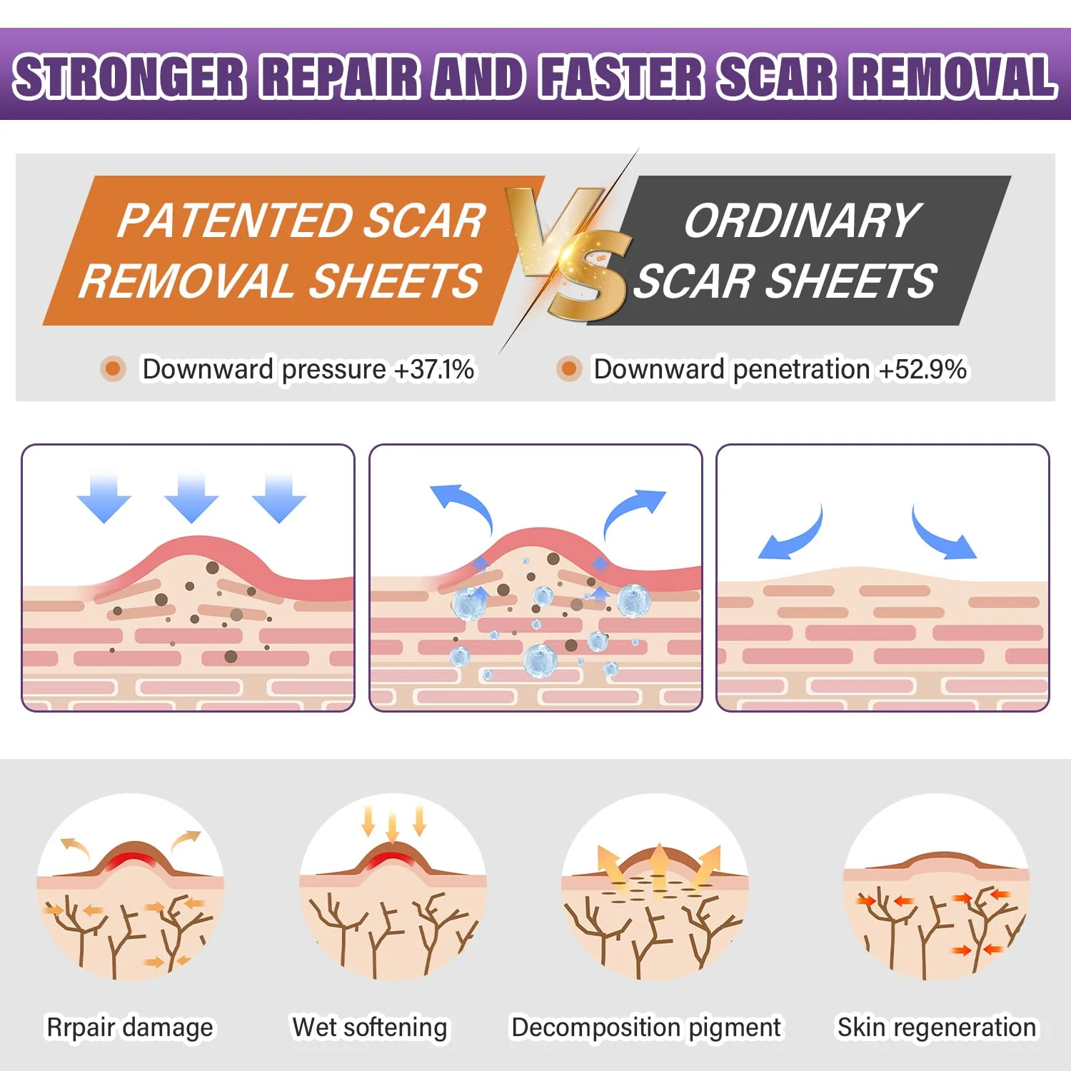 Silicone Scar Sheets,Silicone Scar Tape,Silicone Scar Removal Strips for Surgical,C-Section,Tummy Tuck,Keloid Scars (1.6"X 59" Roll-1.5M) Keloid Bump Removal - Image 3