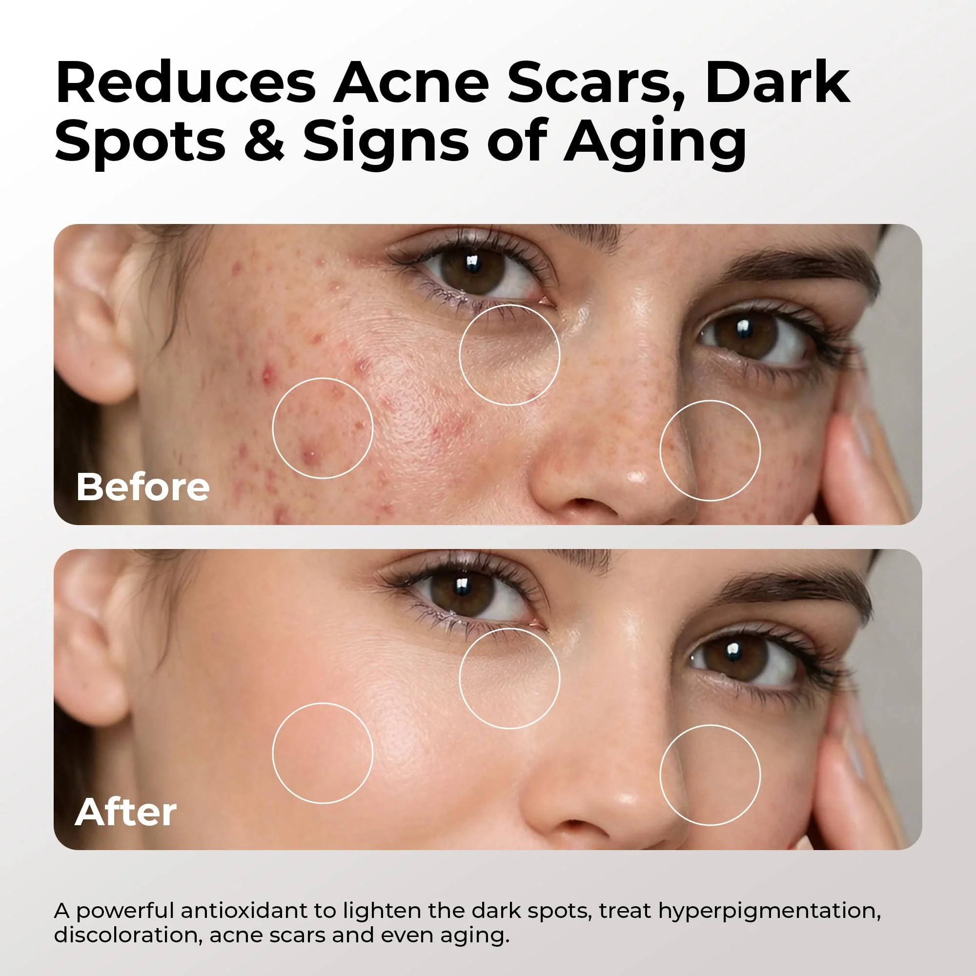 Skin Deva 20% Vitamin C Serum Anti Aging Face Serum with Hyaluronic Acid & Vitamin E – Brightening Formula for Improving Appearance of Dark Spots, Fine Lines & Wrinkles – All Skin Types, 1 fl oz - Image 5