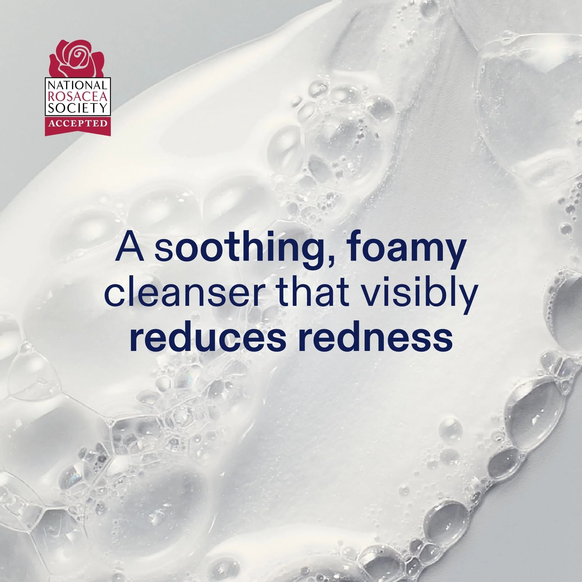 Skinfix Foaming Oil Cleanser for Face - 6 oz - Rich Gel-to-Foam Formula to Hydrate & Soothe Dry, Sensitive Skin - Fragrance Free, Vegan, Cruelty Free - Image 9
