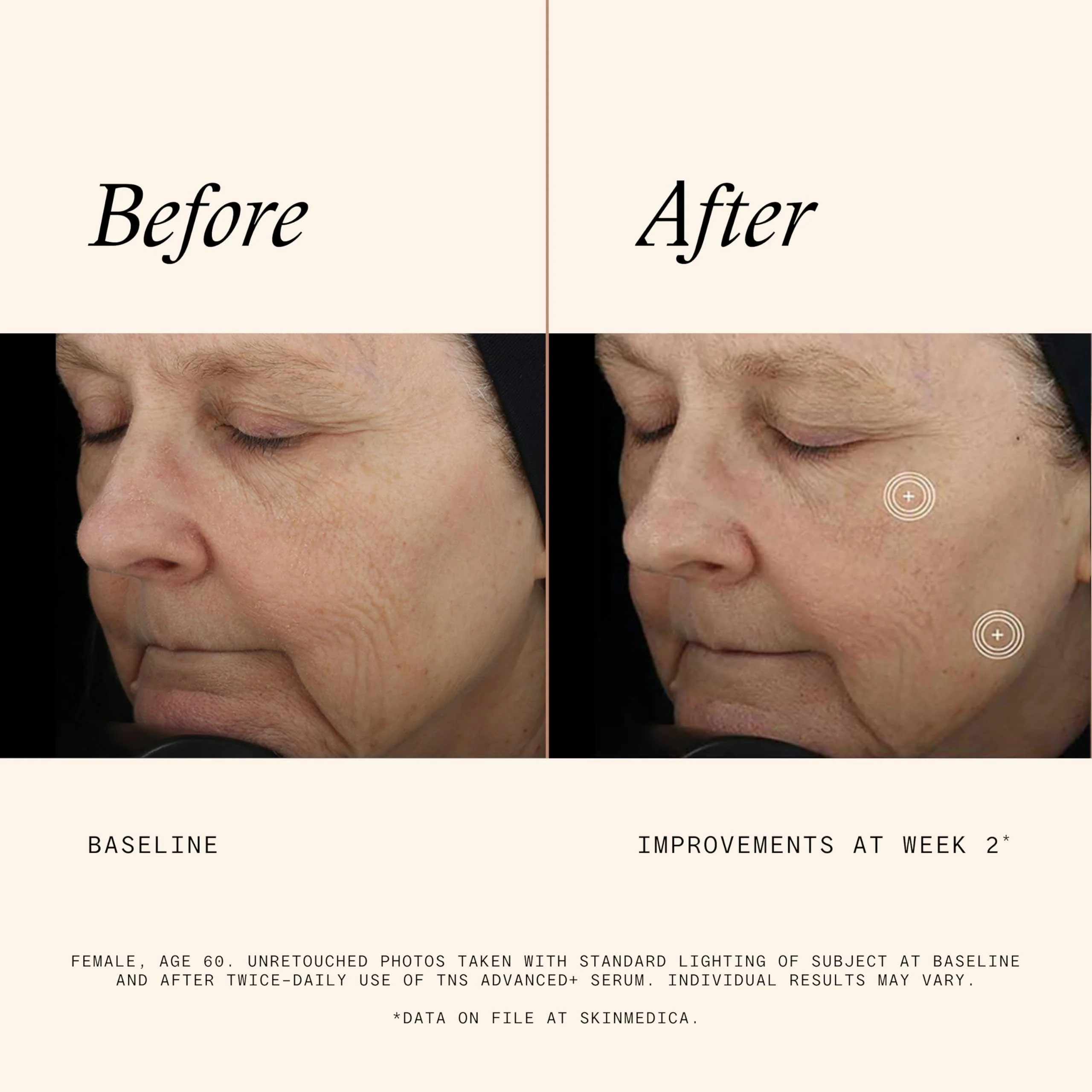 SkinMedica TNS Advanced+ Serum - Our Premium Facial Skin Care Product, the Secret to Flawless Skin. Age-Defying Face Serum for Women is Proven to Address Wrinkles and Fine Lines for Glowing Skin,1 Oz - Image 6