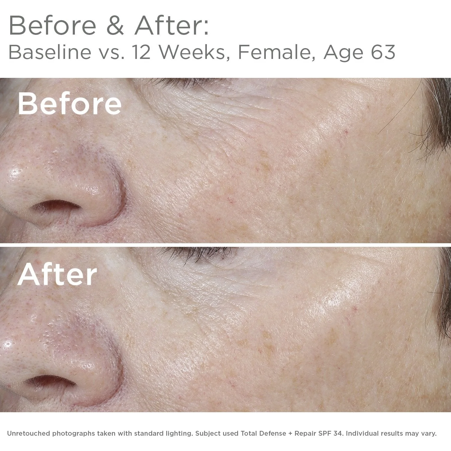 SkinMedica Total Defense + Repair SPF 34 Sunscreen for Face. This Lightweight, Facial Sunscreen is Ideal for Oily and/or Combination Skin, 2.3 Oz - Image 6