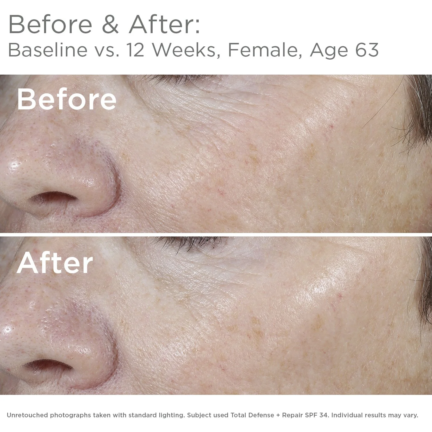 SkinMedica Total Defense + Repair SPF 34 Tinted Sunscreen for Face. This Lightweight, Facial Sunscreen is Ideal for Oily and/or Combination Skin, 2.3 Oz - Image 5