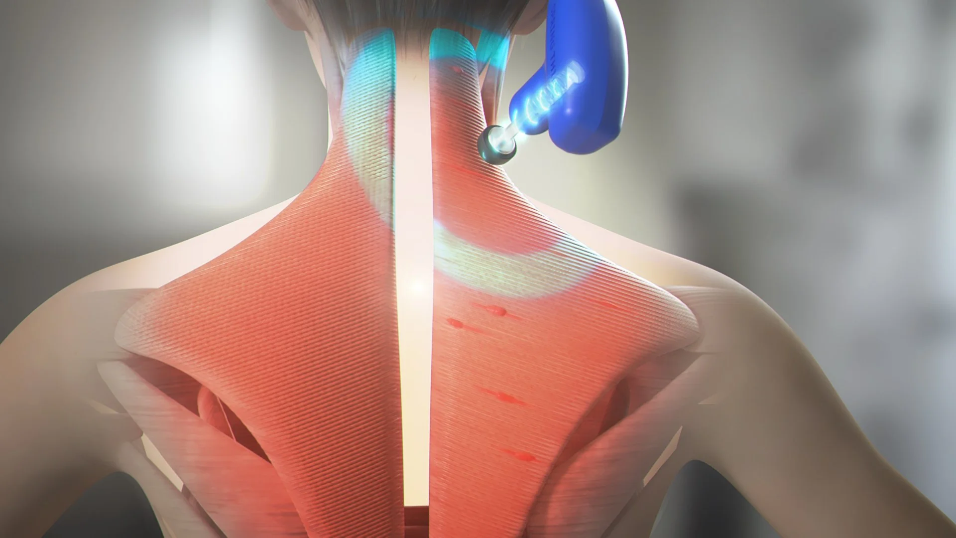 Spring Thing: Pinpoint Massage for Instant Pain and Tension Relief - Image 5