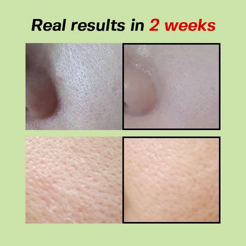 SUNGBOON EDITOR Green Tomato Pore Lifting Ampoule | Pore Minimizer Serum with Niacinamide & Green Tomato Extract | Hydrating & Firming Care for Sensitive Skin | Korean Skincare - Image 5