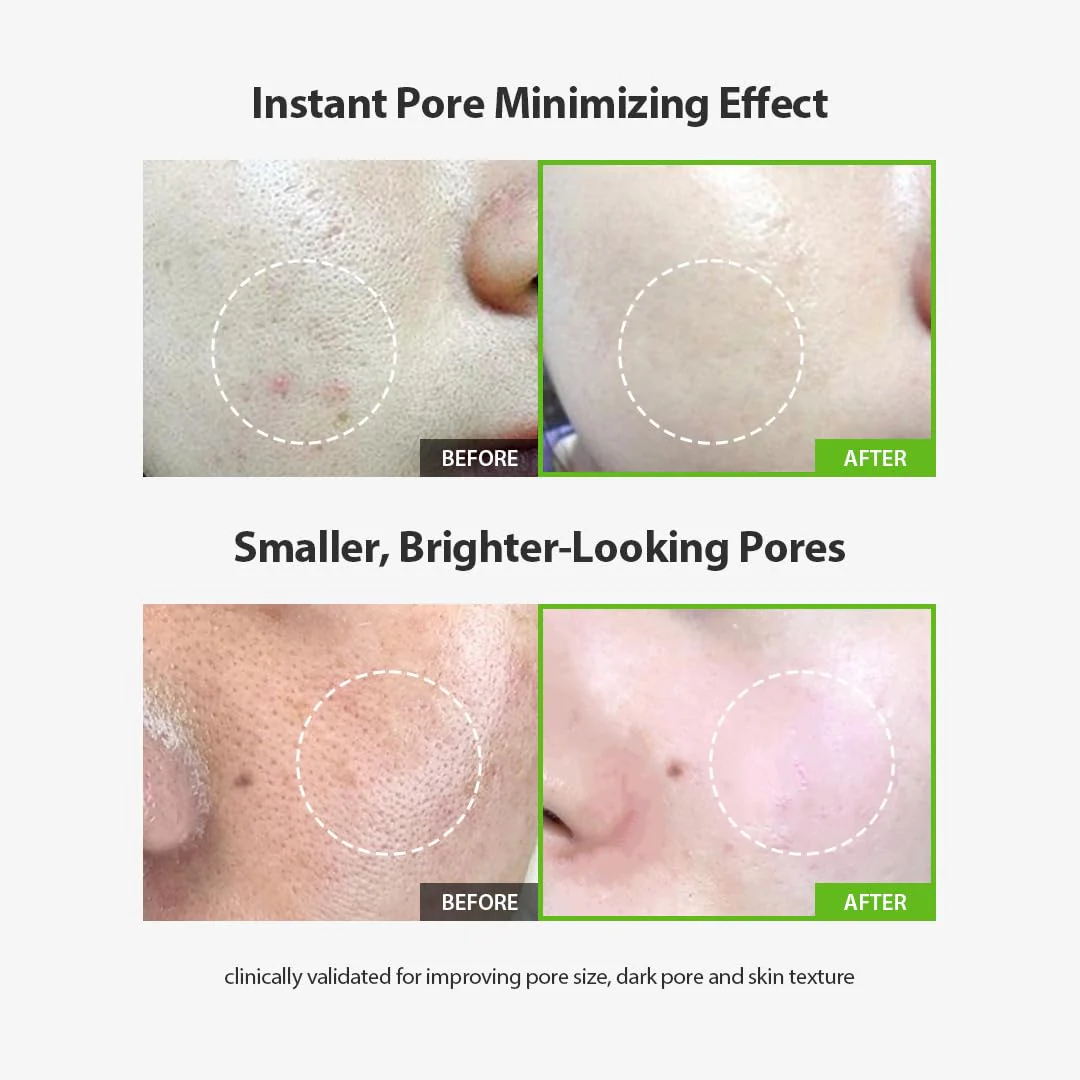 SUNGBOON EDITOR Green Tomato Pore Lifting Ampoule | Pore Minimizer Serum with Niacinamide & Green Tomato Extract | Hydrating & Firming Care for Sensitive Skin | Korean Skincare - Image 9