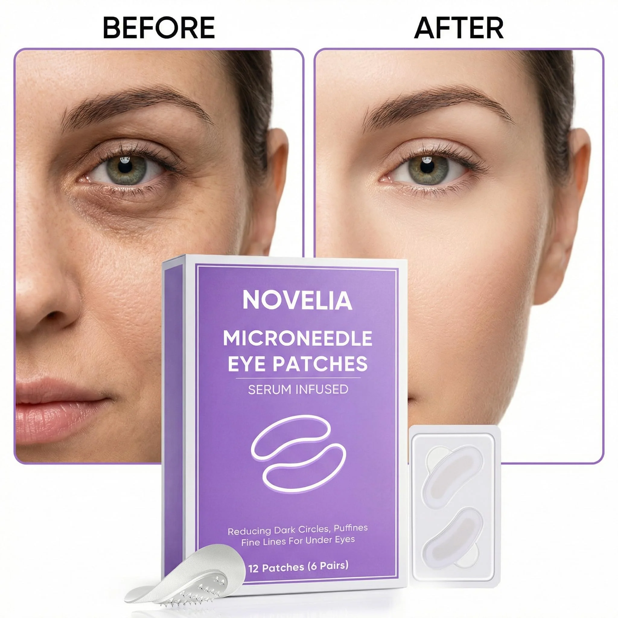 TAWODIUM Novelia Micro Eye Patches, Microglow Undereye Patches, Hyaluronic Acid Serum Infused Eye Masks, Reduce Puffy and Dark Circles, Firming Smile Line, Hydrating & Smoothing Skin (6Pairs) (1 Box) - Image 4