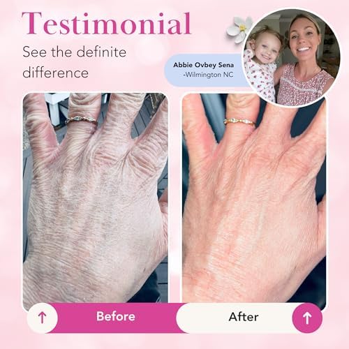 Theraplex Clear Emollient Lotion (8 oz) - No Parabens or Preservatives, Noncomedogenic and Hypoallergenic, Fragrance Free, Dermatologist recommended - National Eczema Association Seal of Acceptance - Image 7
