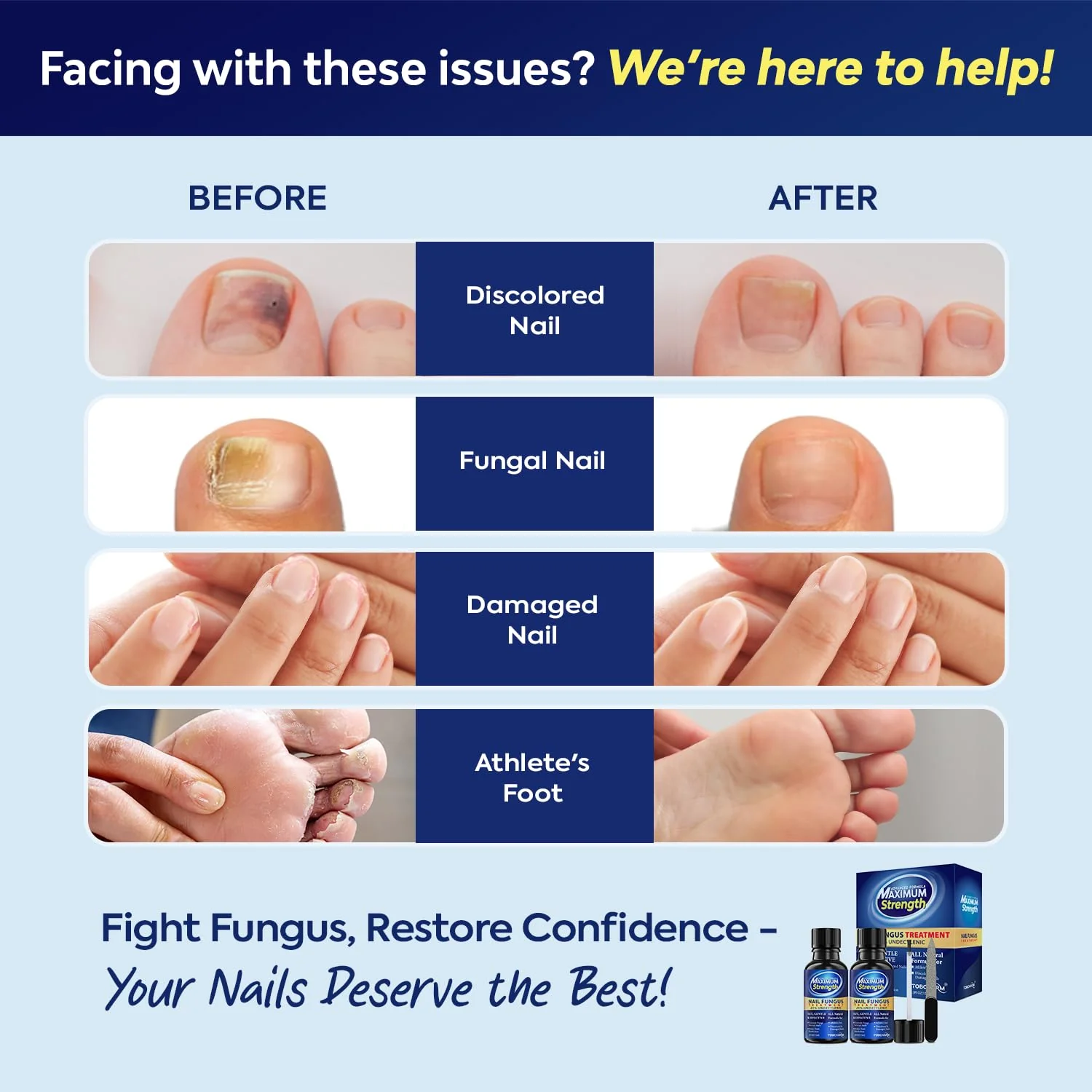 Toenail Fungus Treatment with 25% Undecylenic Acid, Toe Fungus Treatment for Toenail, Fungus Nail Treatment, Toenail Fungus Treatment Extra Strength, Fungal Nail Treatment for Athletes Foot - 2pcs - Image 7