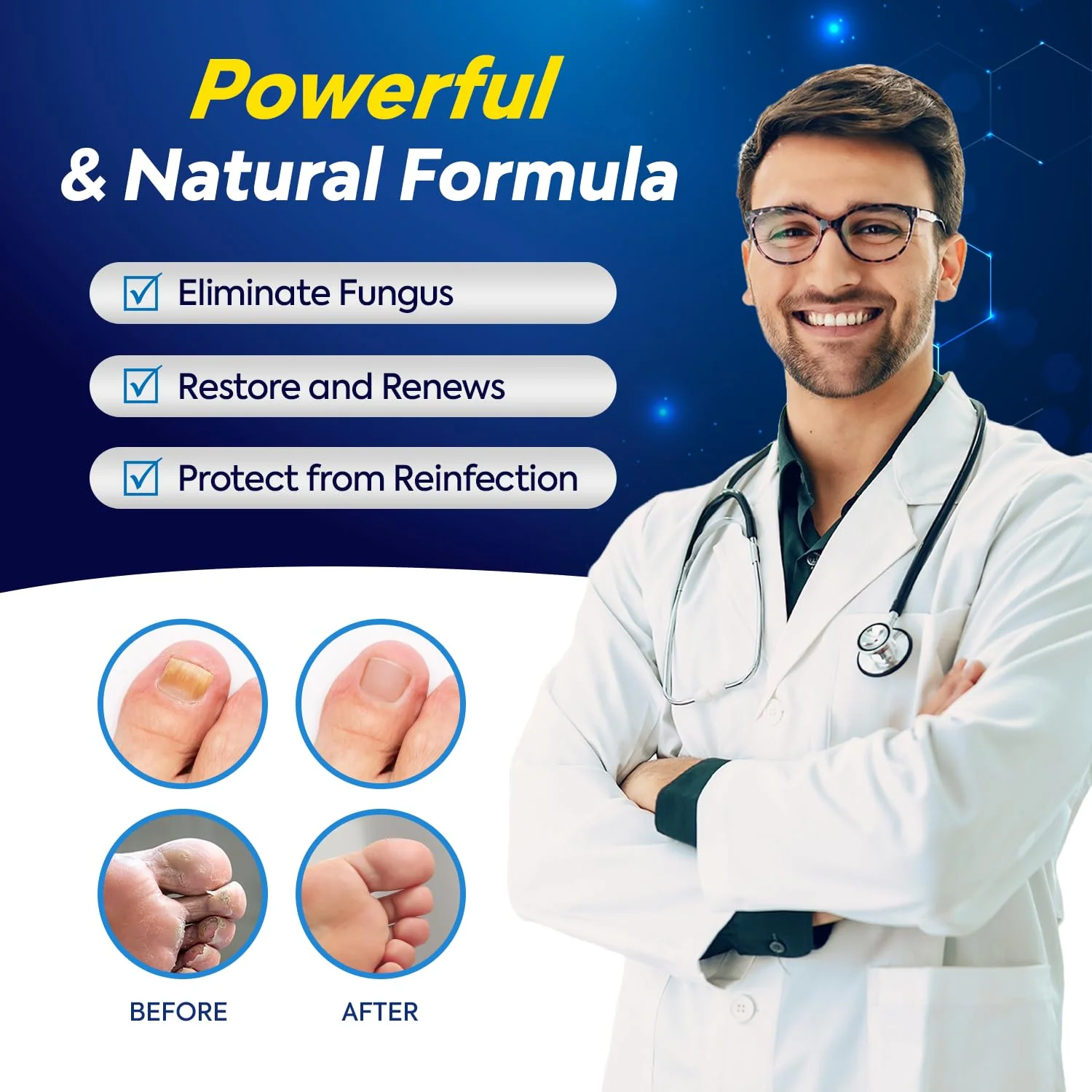 Toenail Fungus Treatment with 25% Undecylenic Acid, Toe Fungus Treatment for Toenail, Fungus Nail Treatment, Toenail Fungus Treatment Extra Strength, Fungal Nail Treatment for Athletes Foot - 2pcs - Image 8