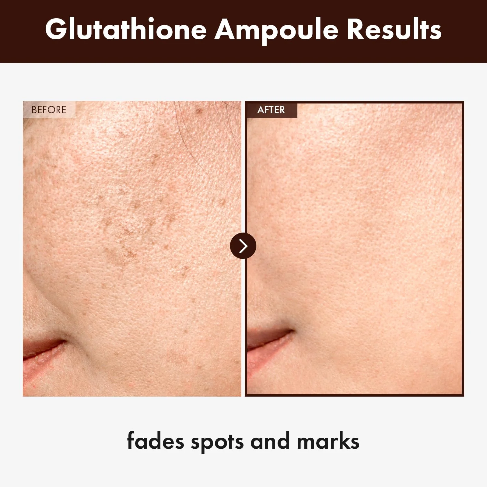 TOSOWOONG Glutathione Serum with 20,000ppm Glutathione, Niacinamide and hyaluronic acid, Dark Spot, Improve skin elasticity, Revitalize complexion, Korean Skincare, 30ml, 1.01 fl. oz. - Image 7