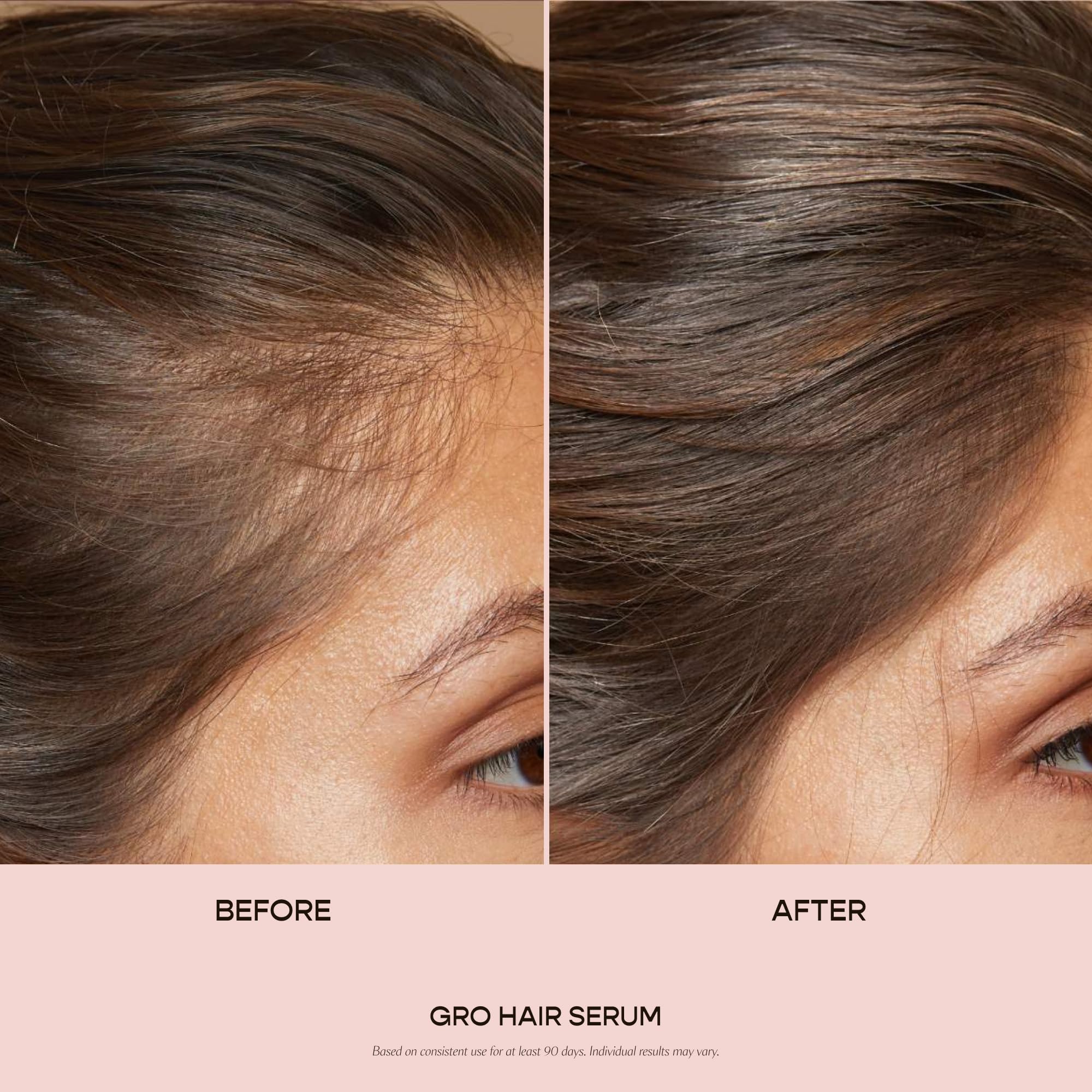 VEGAMOUR GRO Hair Serum for Thinning Hair, Thicker Fuller Looking Hair, Non Oily Tonic for Healthier Scalp, 30 Day Supply 1.0 fl oz, 1 Pack - Image 3