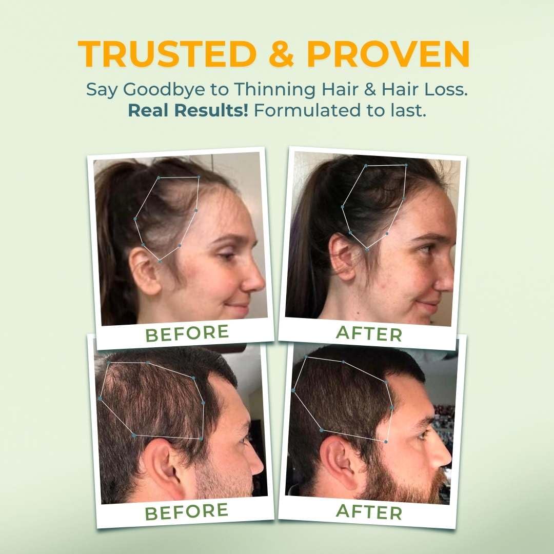 Vital Hair Complex -Hair Growth Vitamins for Women and Men -Biotin & Vitamin B -Hair Growth Supplement for Healthy Hair Skin & Nails -Hormone & Gluten Free -Hair Vitamins for Women - Image 3