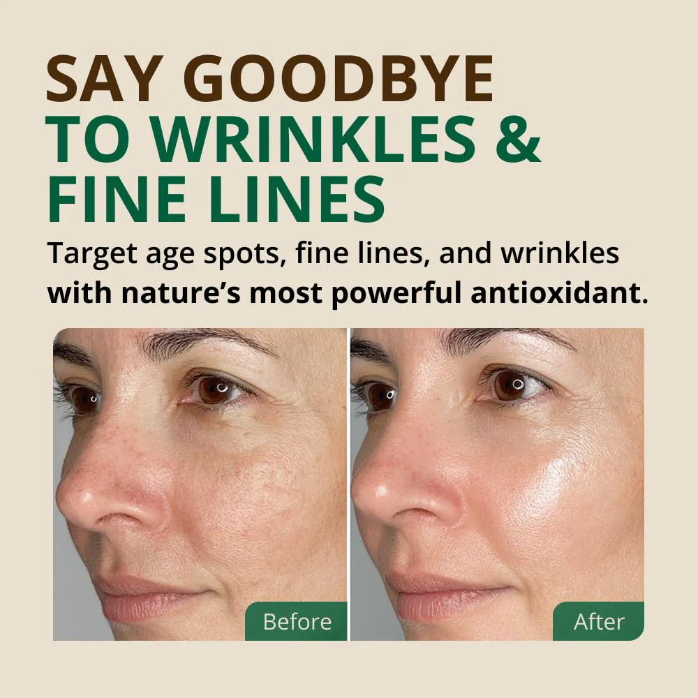 Vitamin E Oil - 100% Pure & Natural, 85,800 IU. Repair Dry, Damaged Skin from Surgery & Acne, Age Spots & Wrinkles. Boost Collagen for Moisturized, Youthful-looking Skin. d-alpha tocopherol, 2 Fl Oz - Image 7