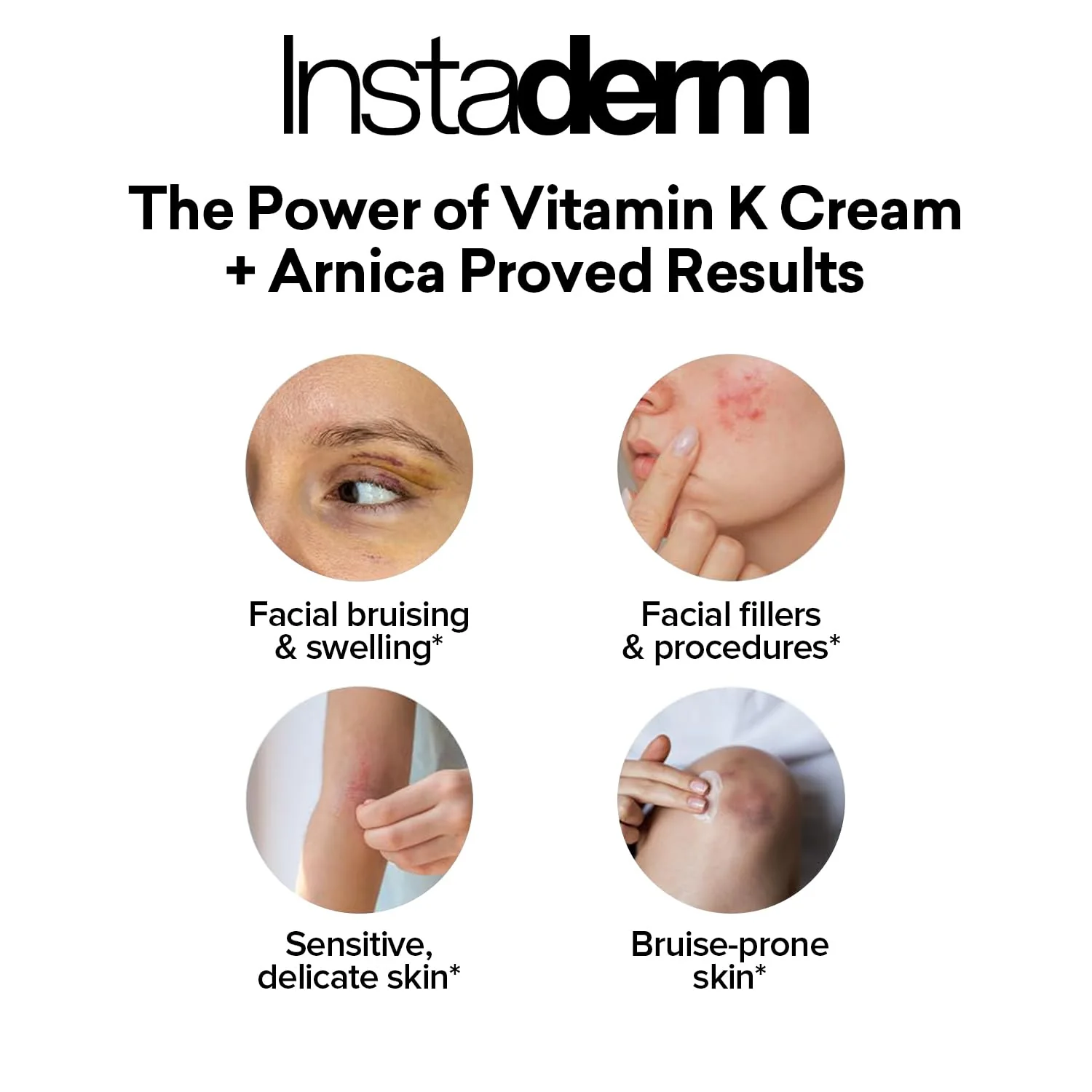 Vitamin K Cream-Revitalizing Formula with Arnica for the Appearance of Brusing, Spider Veins, Broken Capillaries, Uneven Tone & Dark Spot – Under Eye Cream for the Look of Dark Circles & Puffiness - Image 5