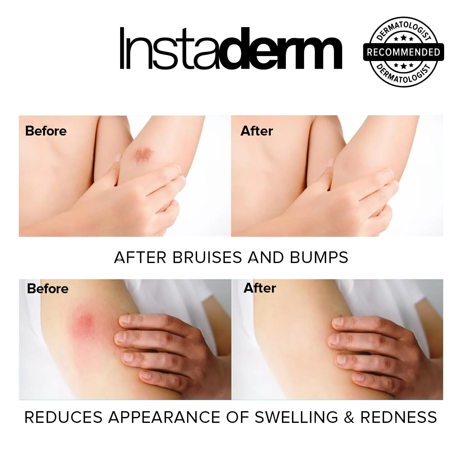 Vitamin K Cream-Revitalizing Formula with Arnica for the Appearance of Brusing, Spider Veins, Broken Capillaries, Uneven Tone & Dark Spot – Under Eye Cream for the Look of Dark Circles & Puffiness - Image 7