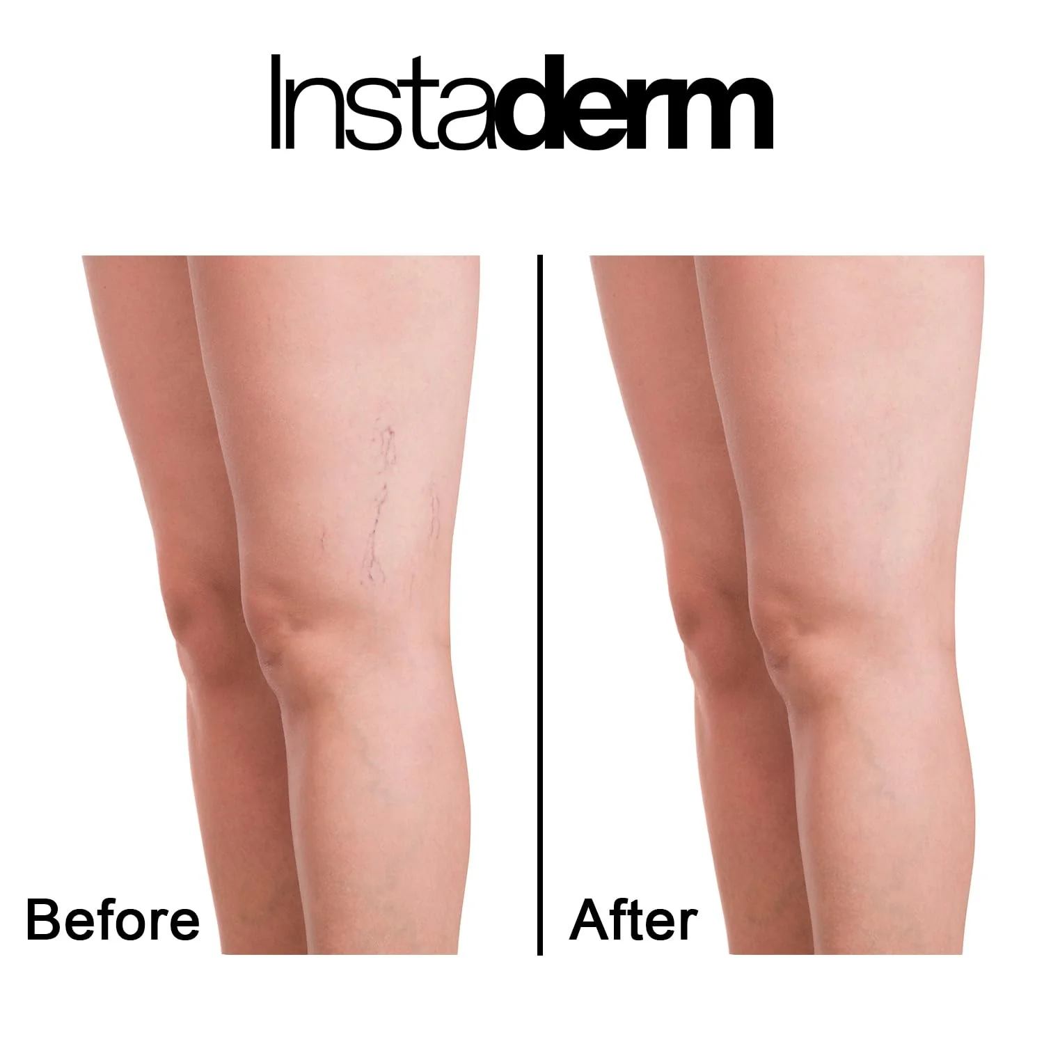Vitamin K Cream-Revitalizing Formula with Arnica for the Appearance of Brusing, Spider Veins, Broken Capillaries, Uneven Tone & Dark Spot – Under Eye Cream for the Look of Dark Circles & Puffiness - Image 9