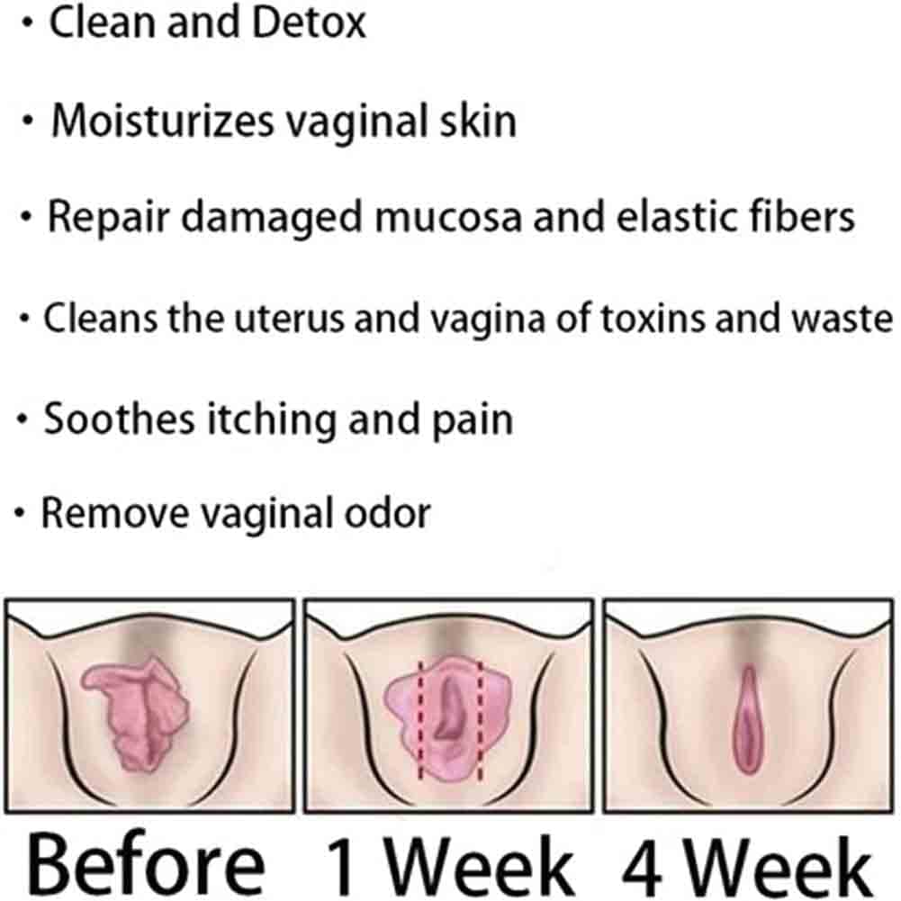 Weabet Instant Anti-Itch Detox Slimming Products, Natural Detox Viginal Capsulesa, Natural Detox Viginal Gel (8Bag) - Image 4