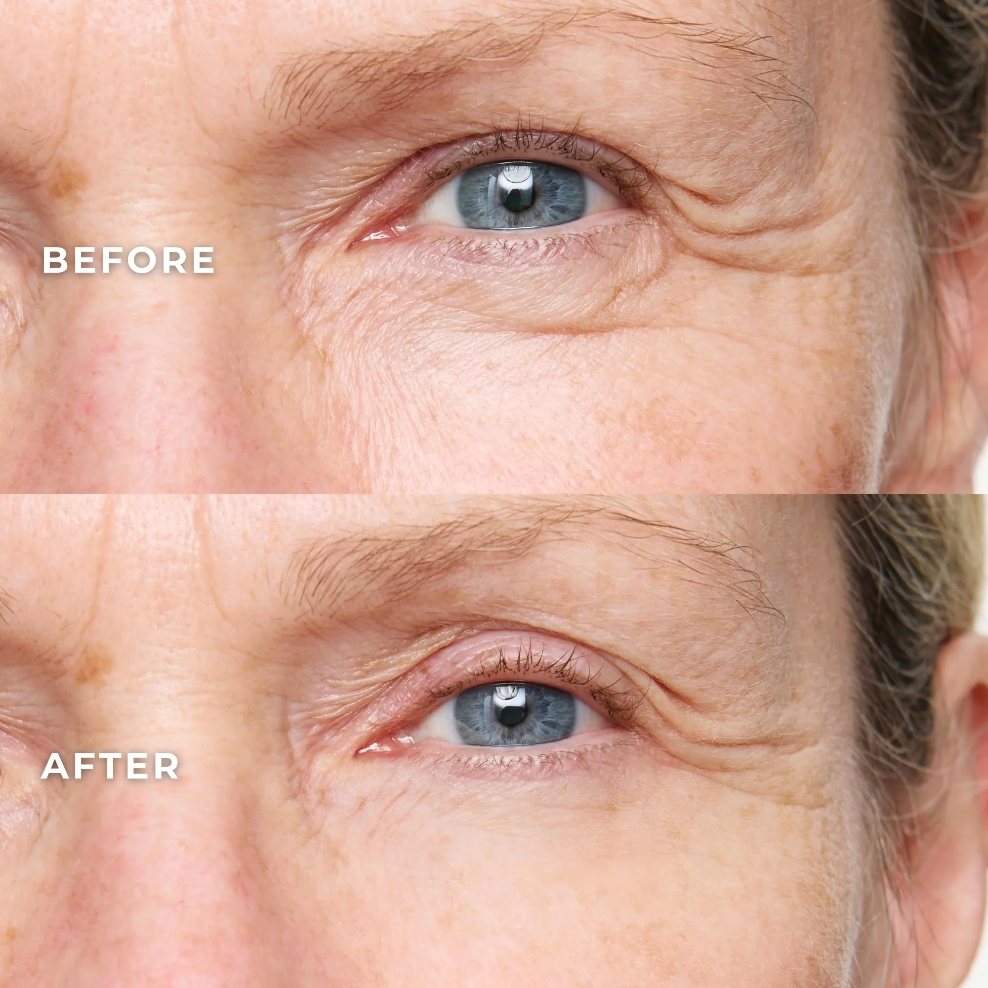 WUNDER2 Wunderlift Instant Eye Tightening Serum, Temporary Firming & Lifting Treatment in 60 Seconds, Reduces Under-Eye Bags, Dark Circles, Puffiness, Anti-aging Fine Lines - Image 6