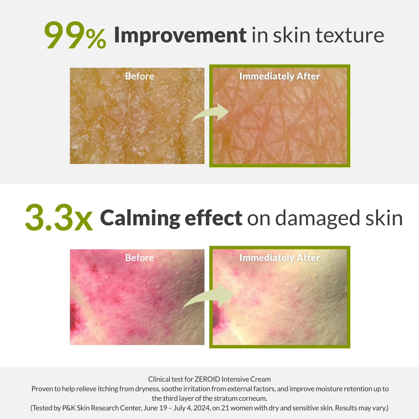 ZEROID | Intensive Cream | Face Moisturizer for Dry & Disordered Skin | Face Cream for Sensitive Skin | Face Lotion For Skin Barrier Repair | Korean Skincare | Korean Moisturizer | 2.7 fl oz (80ml) - Image 6